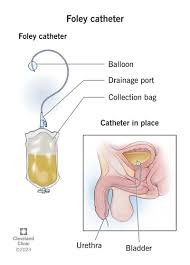 Foley catheter